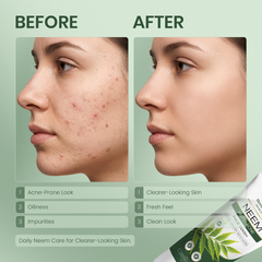 Neem Face Wash for Oily Skin 100ml